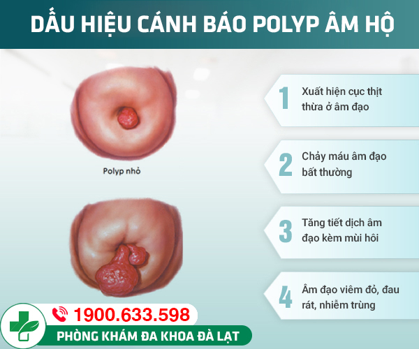 Hình ảnh minh họa